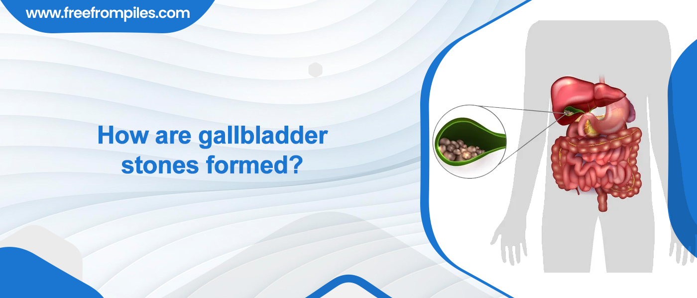 How are gallbladder stones formed?