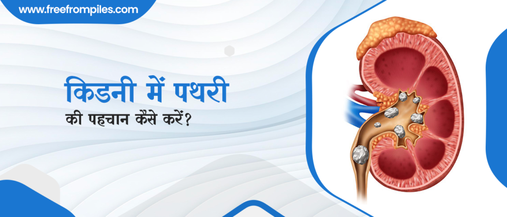 Kidney Stone Symptoms in Hindi