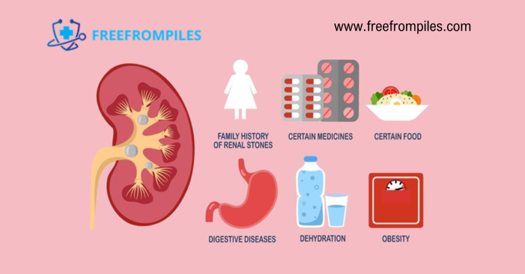 Kidney Stone Risk Factors